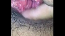 best fvrbklprv hairy butthole and wet pussy closeup best