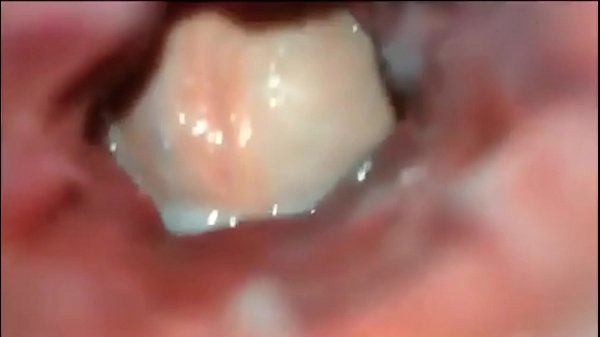 best anal inside view best